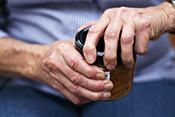 Multiple medical conditions linked to arthritis-causing disease
