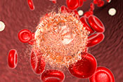 Blood cancer patients with cognitive impairment may have worse survival