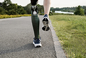 Implanted leg prostheses can improve mobility and reduce back pain