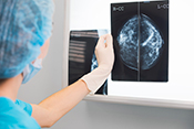 Electronic trigger detects mammogram follow-up delays