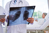 Michigan VA warns of pneumonia misdiagnoses