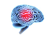 Traumatic brain injury linked to higher psychiatric risk and symptoms