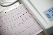 Testosterone replacement therapy could lower risk of atrial fibrillation
