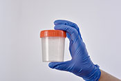 Frequent hospital urine cultures lead to unnecessary antibiotic use