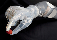 DEKA advanced prosthetic arm gains FDA approval