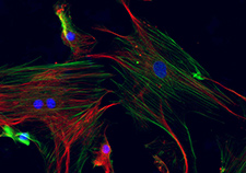 This fluorescence image shows mesenchymal stem cells derived from bone marrow. The blue spots are nuclei, and the green and red filaments are different proteins.
