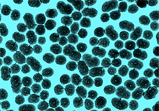 A pseudo-colored microscope image of the bone-building nanoparticles being tested at the Atlanta VA and Emory University.