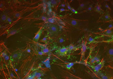 This microscope image shows trabecular meshwork cells created from induced pluripotent stem cells in the lab of Dr. Markus Kuehn. <em>(Image courtesy of Kuehn lab)</em>