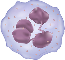 Neutrophils—the most prevalent white blood cells in the body—undergo structural and functional changes when infected by Helicobacter pylori bacteria, found a VA-University of Iowa research team.  