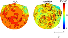Click to enlarge Brain maps based on MEG scan data highlight differences between Veterans with and without Gulf War illness.