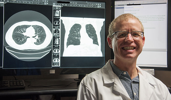  Dr. Christopher Slatore of the VA Portland Health Care System is co-author of a review study that explored patient reaction and doctor-patient interaction in cases when a lung nodule is detected. (Photo by Michael Moody)  