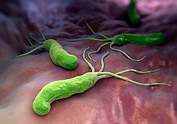 <em>Helicobacter pylori</em> burrow deep within the mucous lining of the stomach and could cause serious gastrointestinal problems.
