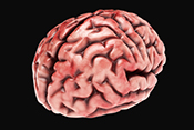 Gene linked to thinner cortex in PTSD patients - Photo: ©iStock/Denes Farkas
