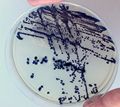 C. difficile treatment with vancomycin results in fewer deaths than treatment with metronidazole