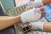 High-dose folic acid may improve diabetic foot ulcer healing - Photo: iStock/MangTeng