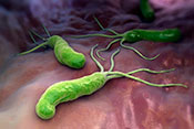 <em> H. pylori</em> treatment may raise risk of autoimmune disease - Photo: ©iStock/iLexx