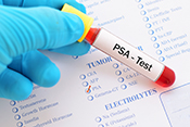 Low-value prostate cancer screening prevalent in VA