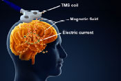Brain structures account for transcranial magnetic stimulation effectiveness - 