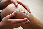 New technique could improve wound healing -  Photo: ©iStock/yenwen