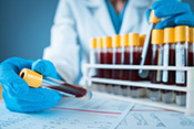 VA medical centers participating in large COVID-19 treatment study on convalescent plasma