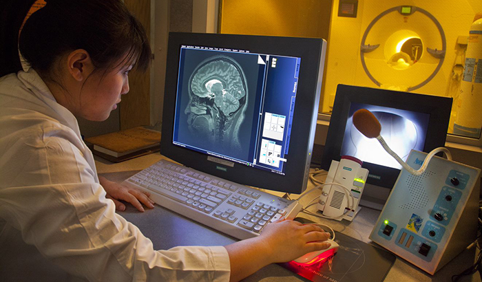 MRI brain scans, as depicted in this photo from the San Francisco VA Healthcare System, are among the more promising biomarker approaches for diagnosing Alzheimer’s disease, according to a new VA review study. (Photo by Roy Kaltschmidt) 