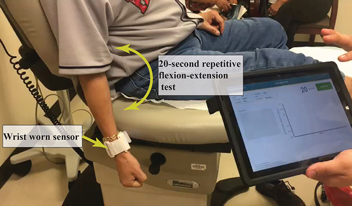 While wearing a wrist sensor, the patient flexes the elbow repeatedly for 20 seconds. Photo courtesy of Dr. Bijan Najafi.