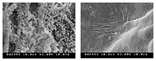 These photos, from a VA-UF study published in the journal Ulcers in 2013, show a microscopic view of a biofilm, grown in the lab on a piece of pig skin. The 