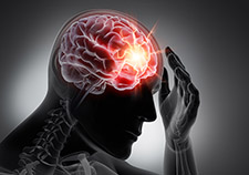 Innovative psychotherapy eases headache symptoms for Veterans with brain injuries