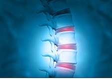 Injectable gel could help treat degenerative back pain