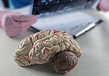 New hope for TBI, Alzheimer’s 