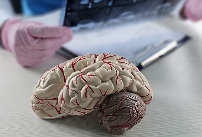 New VA research protects the blood-brain barrier to prevent cognitive decline from traumatic brain injury and Alzheimer's.   Â©iStock/Nadzeya Haroshka
