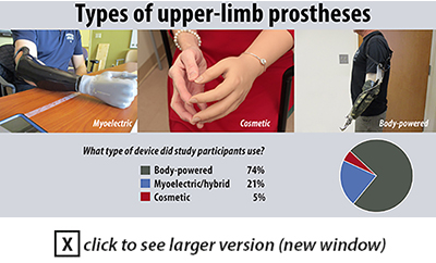 Types of upper limb prostheses