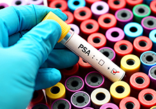 Prostate Cancer: Study Finds No Statistical Difference Between Surgery, Observation in Reducing Deaths