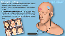   Social cognition in schizophrenia