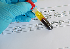 Study suggests possible ties between low cholesterol levels and suicide risk in Vets