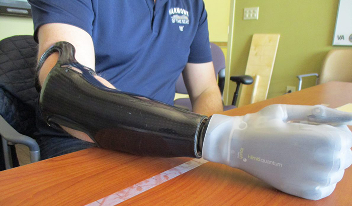 Veterans who use either lower-limb or upper-limb prosthetic devices, such as the myoelectric arm shown here, stand to benefit from work being done at the Cleveland VA to develop new materials for socket liners. (Photo courtesy of Providence VAMC) 