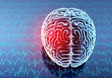 Study: Veterans with multiple brain injuries twice as likely to consider suicide, compared with those with one or none
