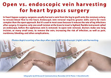  Open vs. endoscopic vein harvesting for hearh bypass surgery
 (VA Research Communications)
