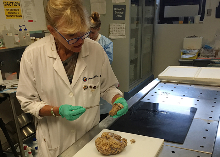 Pathologist Dr. Ann McKee is part of the team behind VA's National PTSD Brain Bank. (Photo courtesy of VA Boston Healthcare System)