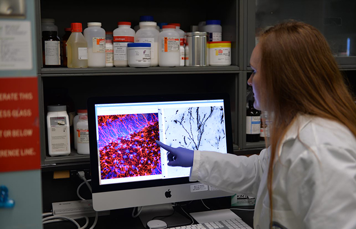 Dr. Whitney Ratliff, who carried out the experiments and analyzed the data in the study, points to injured brain cells in the hippocampus, an important memory center in the brain.  Photo by Timothy J. Westmorland)