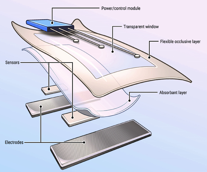 Exciflex was created from smart bandage technology developed by Dr. Kath Bogie and colleagues at the VA Advanced Platform Technology Center and Case Western Reserve University in Cleveland. (Illustration by Grace Gongaware)