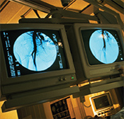 Cardiovascular Disease