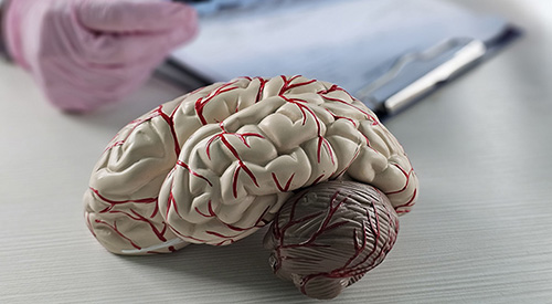 RNew hope for TBI, Alzheimer's