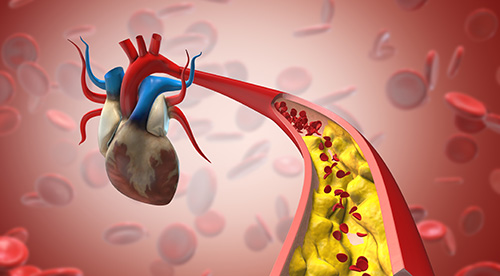 Gulf War exposures and heart disease risk