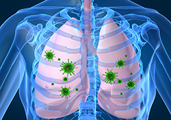  Bacteria in the lungs of patients with COPD may do more harm than previously thought, according to a study by researchers with VA and the University of
    Buffalo. <em>(Photo: iStock)</em>