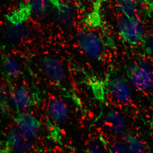 Brain cells called microglia, seen in green, can be seen pruning synapses, in red, in this microscopic image from the brain of a mouse model of frontotemporal dementia. Dr. Eric Huang's research shows that overly aggressive pruning by microglia may drive this form of dementia. <em>(Image courtesy of Huang lab)</em>